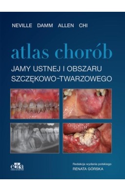 Atlas chorób jamy ustnej i obszaru szczękowo..