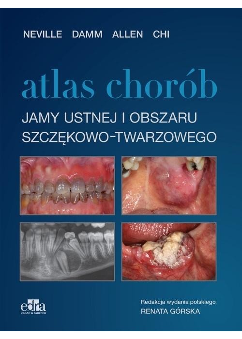 Atlas chorób jamy ustnej i obszaru szczękowo..