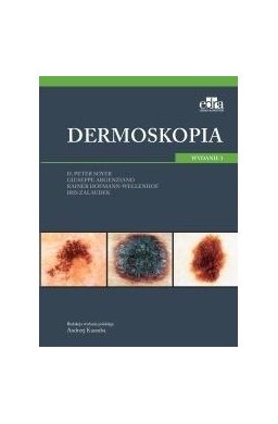 Dermoskopia