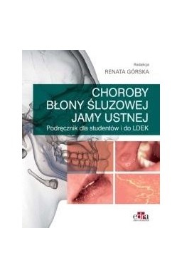 Choroby błony śluzowej