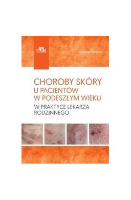 Choroby skóry u pacjentów w podeszłym wieku