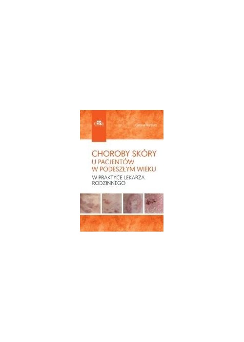 Choroby skóry u pacjentów w podeszłym wieku