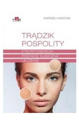 Trądzik pospolity. Etiopatogeneza. Postacie...