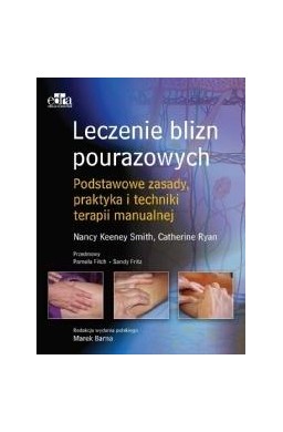 Leczenie blizn pourazowych