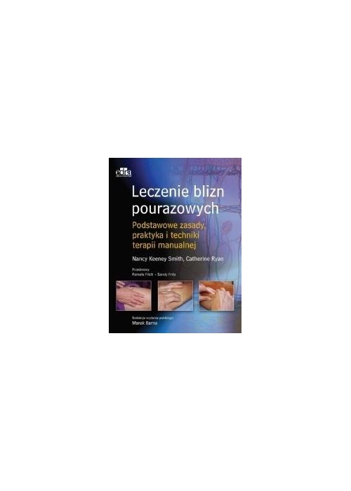 Leczenie blizn pourazowych