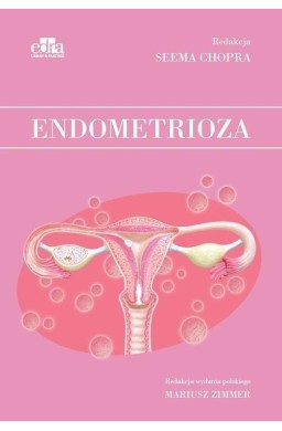 Endometrioza