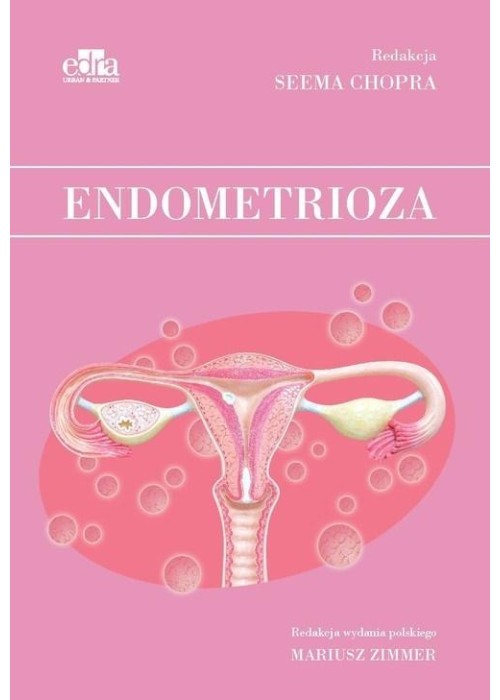 Endometrioza