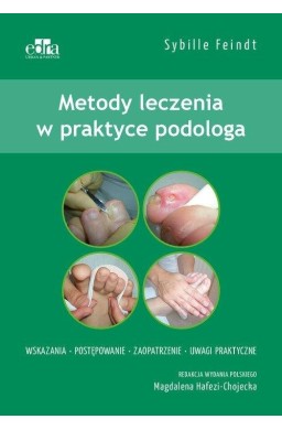 Metody leczenia w podologii