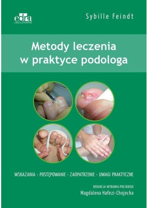 Metody leczenia w podologii