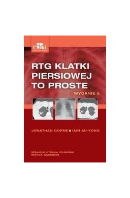 RTG klatki piersiowej