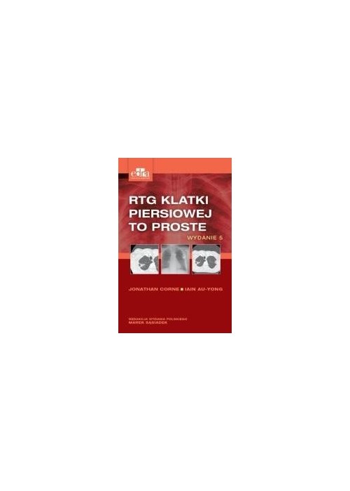 RTG klatki piersiowej