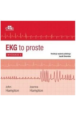 EKG to proste