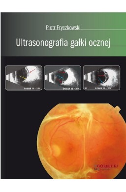 Ultrasonografia gałki ocznej
