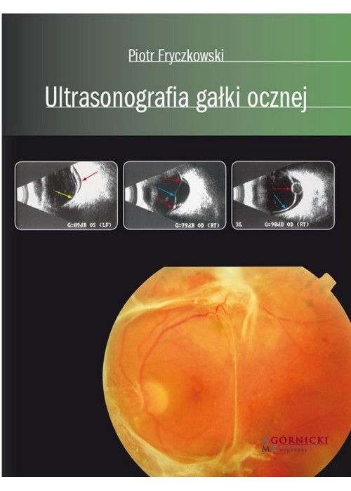 Ultrasonografia gałki ocznej