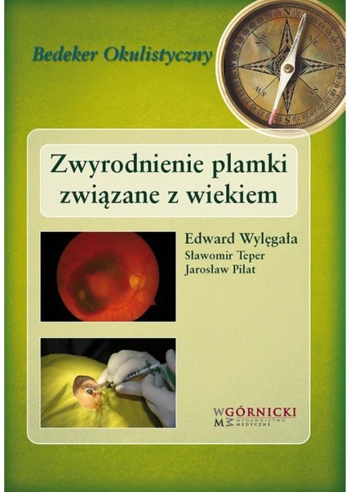 Zwyrodnienie plamki związane z wiekiem