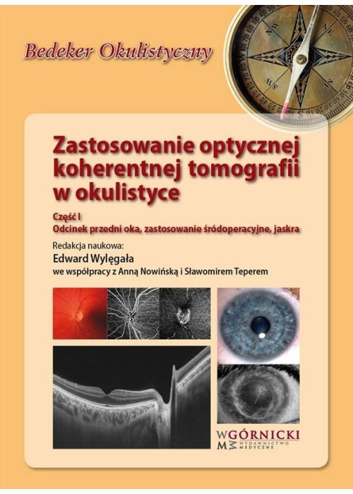Zastosowanie optycznej koherentnej tomografii cz.1