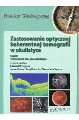 Zastosowanie optycznej koherentnej tomografii cz.2