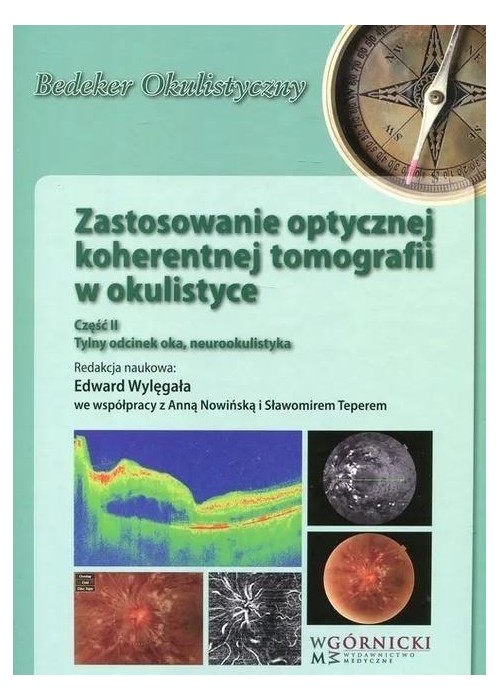 Zastosowanie optycznej koherentnej tomografii cz.2
