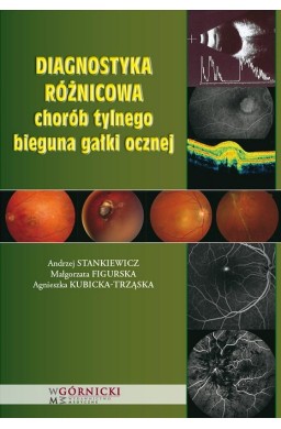 Diagnostyka różnicowa chorób tylnego bieguna...
