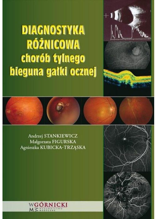 Diagnostyka różnicowa chorób tylnego bieguna...