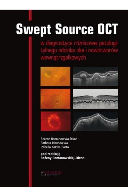 Swept Source OCT w diagnostyce patologii tylnego..