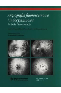 Angiografia fluoresceinowa i indocyjaninowa
