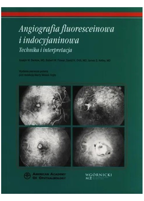 Angiografia fluoresceinowa i indocyjaninowa