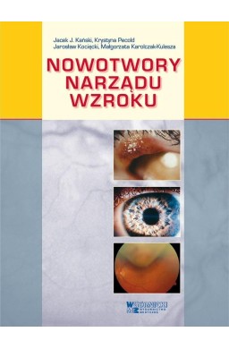 Nowotwory narządu wzroku