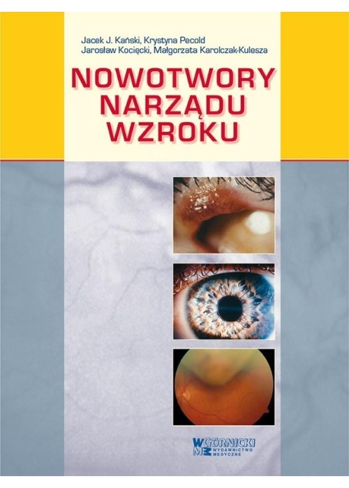 Nowotwory narządu wzroku