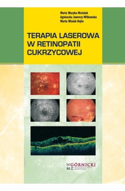 Terapia laserowa w retinopatii cukrzycowej