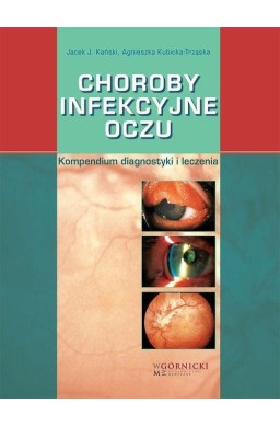 Choroby infekcyjne oczu. Kompendium diagnostyki...