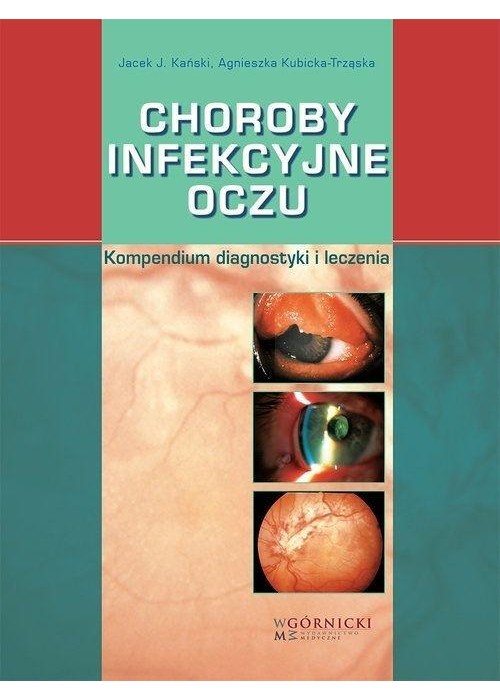 Choroby infekcyjne oczu. Kompendium diagnostyki...