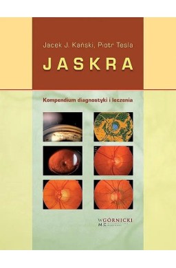 Jaskra. Kompendium diagnostyki i terapii