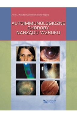 Autoimmunologiczne choroby narządu wzroku