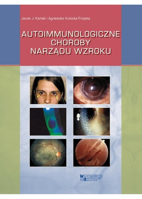 Autoimmunologiczne choroby narządu wzroku