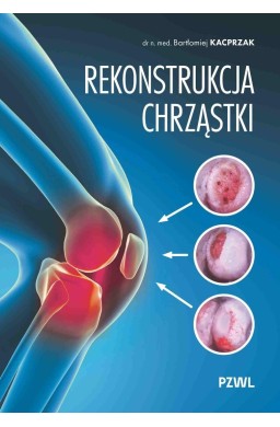 Rekonstrukcja chrząstki