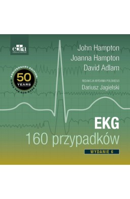 EKG 160 przypadków