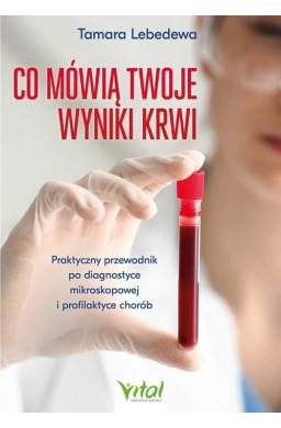 Co mówią twoje wyniki krwi