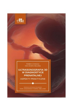 Ultrasonografia 3D w diagnostyce prenatalnej