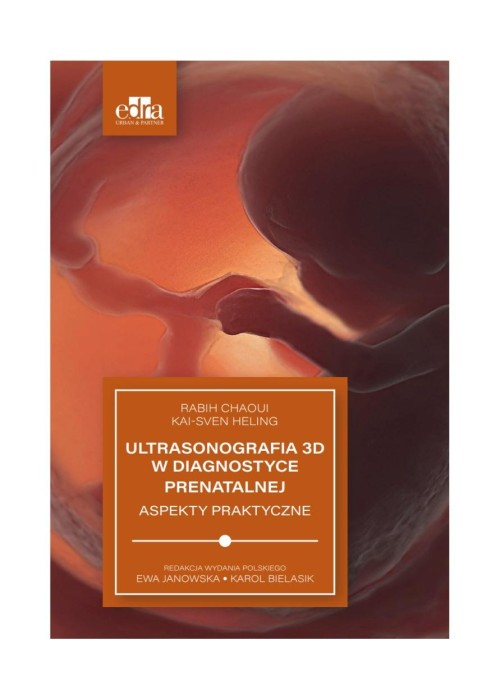 Ultrasonografia 3D w diagnostyce prenatalnej