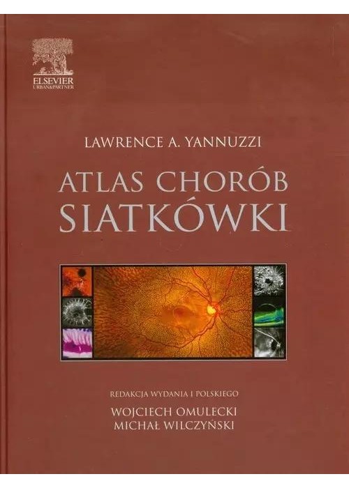 Atlas chorób siatkówki