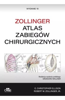 Atlas zabiegów chirurgicznych. Zollinger