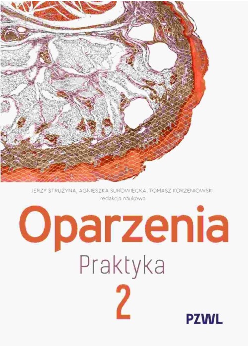 Oparzenia. Praktyka T.2
