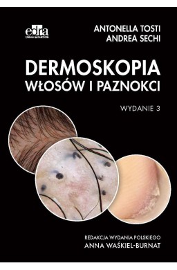 Dermoskopia włosów i paznokci