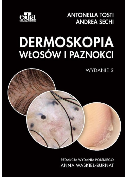 Dermoskopia włosów i paznokci
