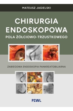 Chirurgia endoskopowa pola żółciowo-trzustkowego
