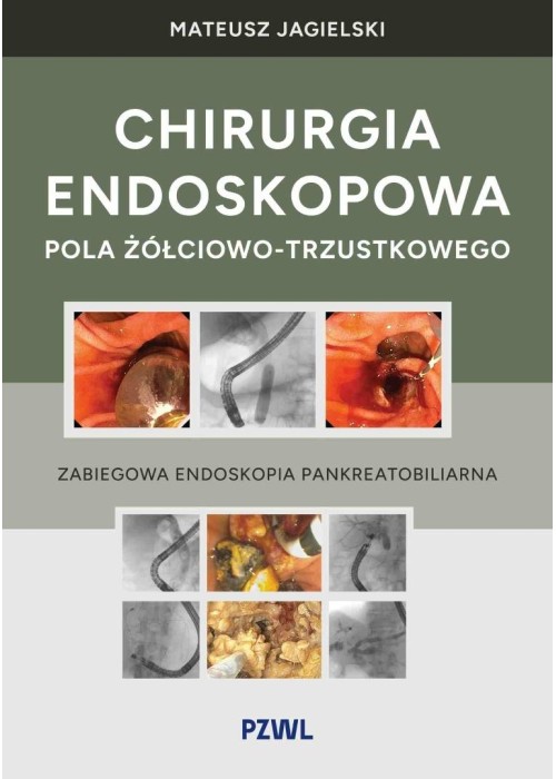 Chirurgia endoskopowa pola żółciowo-trzustkowego