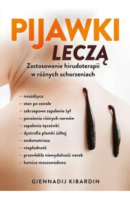 Pijawki leczą. Zastosowanie hirudoterapii...