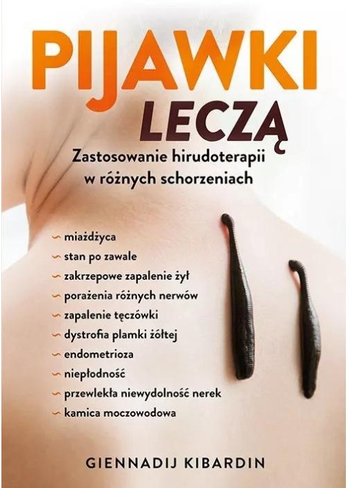 Pijawki leczą. Zastosowanie hirudoterapii...