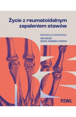 Życie z reumatoidalnym zapaleniem stawów